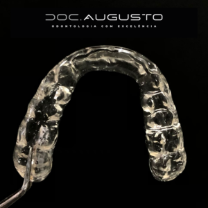 Tratamento de Bruxismo